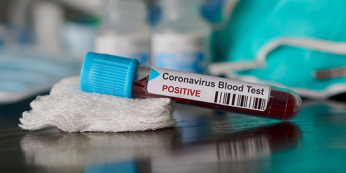 coronavirus