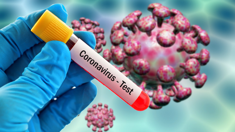 coronavirus