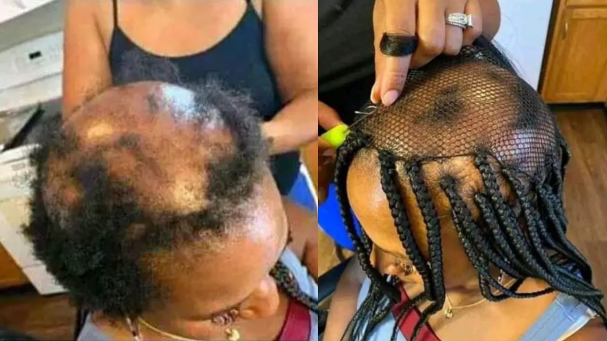 Fear Hairdressers! See Photographs Of How Beautician Meshed An Uncovered Lady's Hair. 52