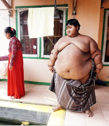 World's fattest boy undergoes incredible transformation after losing some weight. 46